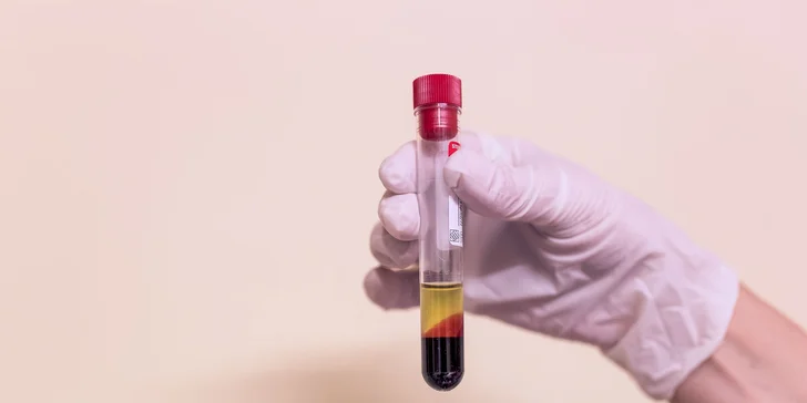Vitamíny, kyselina hyalurónová či Dracula lift Vital injectorom