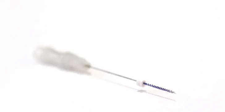 Odstraňovanie vrások mezoniťami Screw