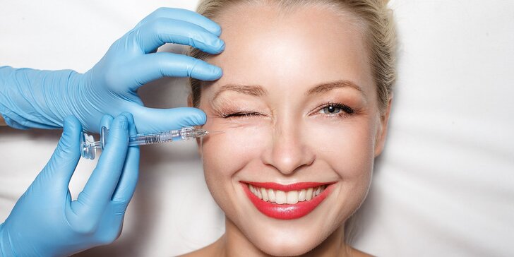 Aplikácia botoxu Bocouture do medziobočia, čela a okolia očí