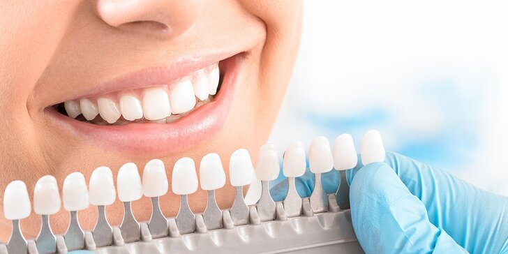 Laserové bielenie zubov PEARLSMILE® v Košiciach aj v Prešove