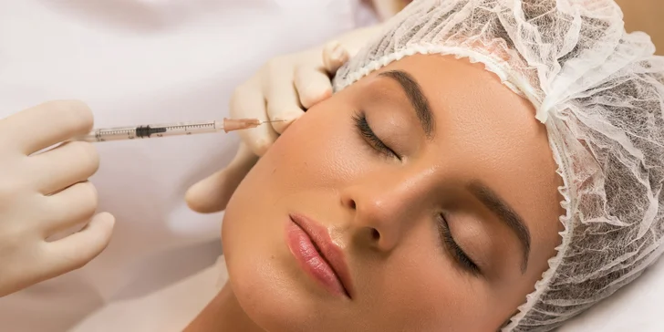 Aplikácia 1,5 ml kyseliny hyalurónovej do oblasti tváre