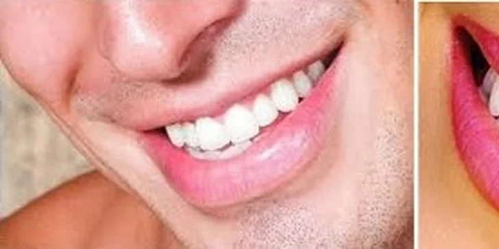 Dentálna hygiena
