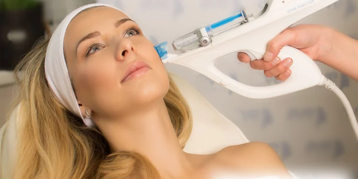 Unikátna vitamínová mezoterapia s Dermaheal HSR