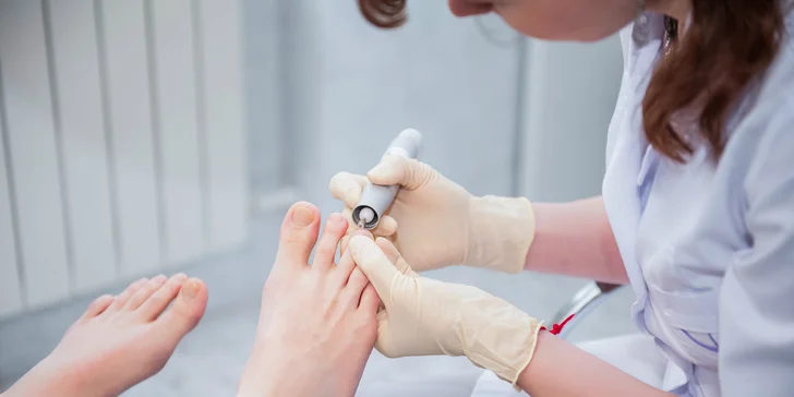 Medicinálna suchá pedikúra s možnosťou gél laku