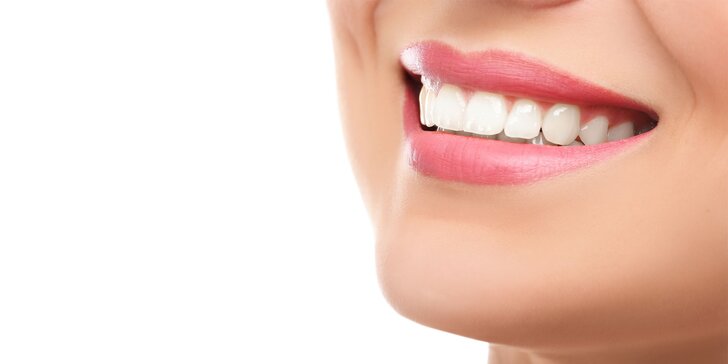 Laserové bielenie zubov v Prestige