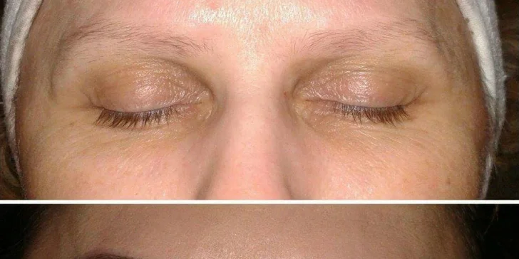 Permanentný make up obočia, očných liniek a pier