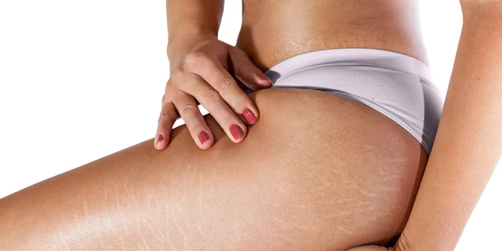 Ošetrenie microneedling v Luvi studio