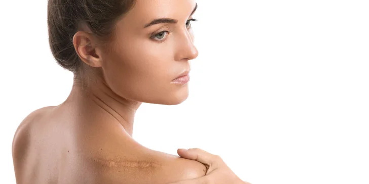 Ošetrenie microneedling v Luvi studio