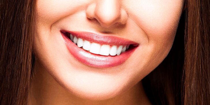 Laserové bielenie zubov bez peroxidu