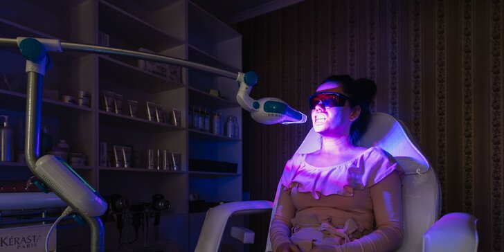 Bielenie zubov LED svetlom bez peroxidu