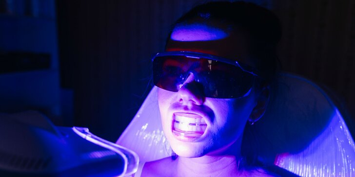 Bielenie zubov LED svetlom bez peroxidu