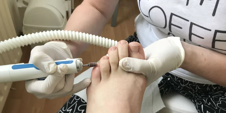 Mokrá, suchá či kombinovaná pedikúra v Lipanoch aj u vás doma