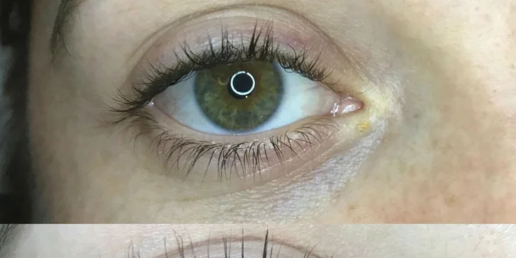 Lash&Lifting kúra: vytočenie rias so špeciálnymi natáčkami