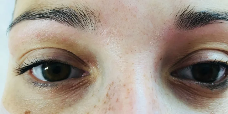 Lash&Lifting kúra: vytočenie rias so špeciálnymi natáčkami