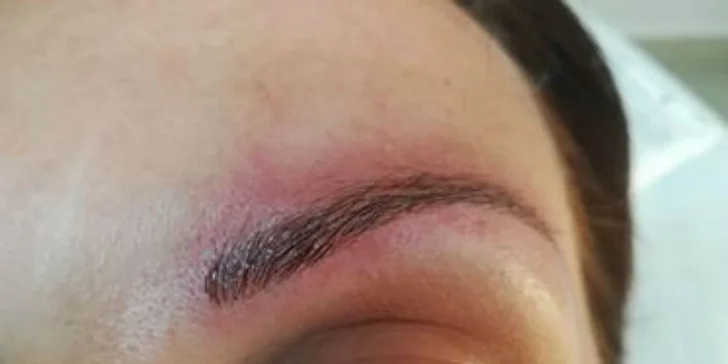 3D čiarkované obočie metódou Microblading