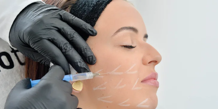 Injekčná mezoterapia či mezoterapia Vital Injectorom Skinbooster