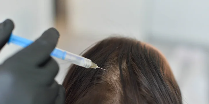 Injekčná mezoterapia či mezoterapia Vital Injectorom Skinbooster