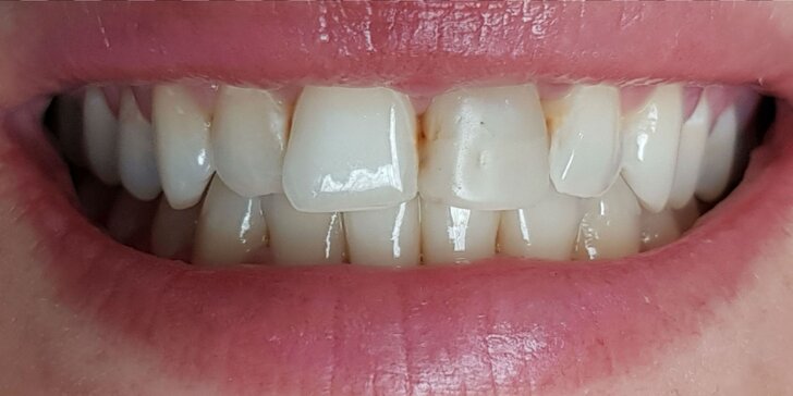 Dentálna hygiena, bielenie zubov či panoramatické RTG