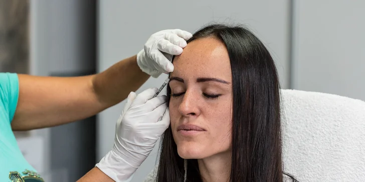Aplikácia botulotoxínu proti vráskam v salóne Dermafresh