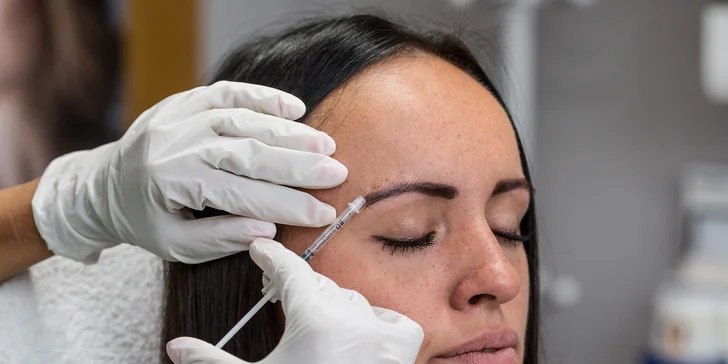 Aplikácia botulotoxínu proti vráskam alebo poteniu v salóne Dermafresh