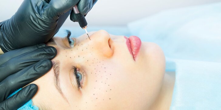 Tetovanie pieh pomocou prístroja na permanentný make-up