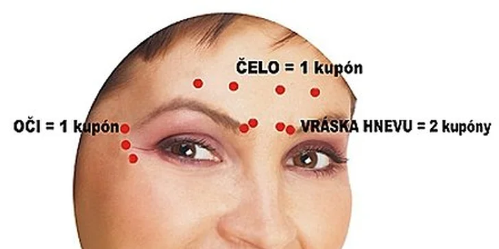 30 eur za ošetrenie vrások botulotoxínom! Metóda overená rokmi a tisíckami spokojných zákazníkov, ktorí naplno prežívajú svoju mladosť čo najdlhšie! Teraz so zľavou 50%!