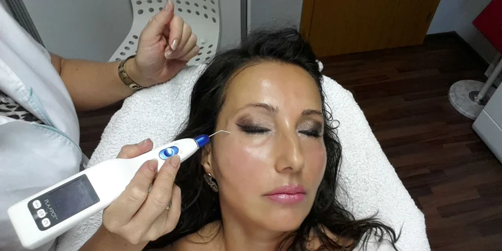 Ošetrenie prístrojom Plaxpot v salóne Dermafresh v Senci