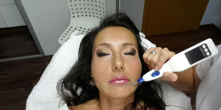 Novinka - ošetrenie prístrojom Plaxpot v salóne Dermafresh v Senci