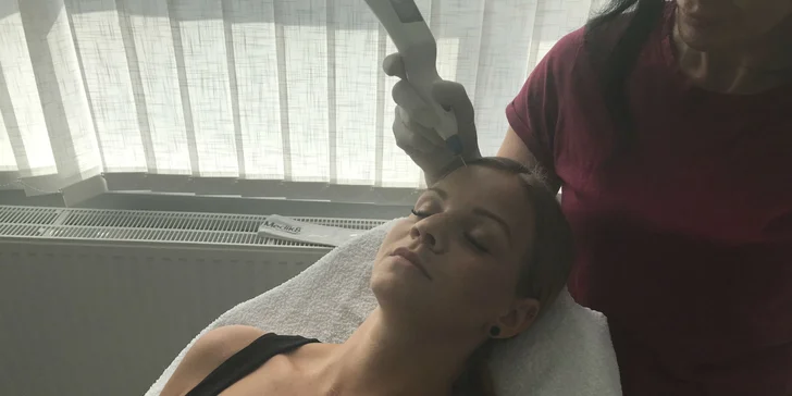Nechirurgický lifting tváre či odstránenie pigmentových škvŕn