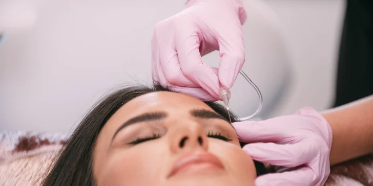Unikátna neinvazívna karboxyterapia v BSM beauty