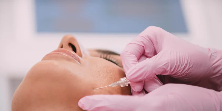 Unikátna neinvazívna karboxyterapia v BSM beauty