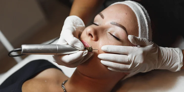 Neinvazívna metóda v boji proti vráskam Fibroblast