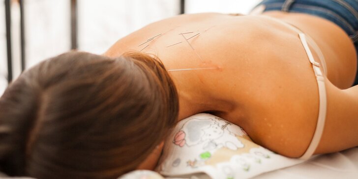 Akupunktúra s diagnostikou stavu pacienta u čínskych masérov