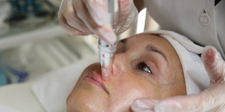 Účinný chemický peeling, hĺbkové čistenie či mezoterapia tváre