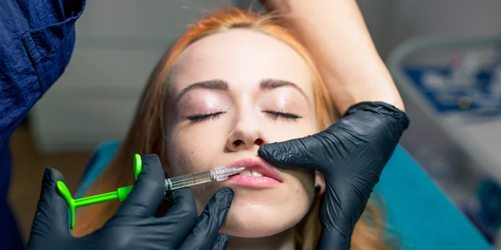 Vyplnenie vrások a pier kyselinou hyalurónovou alebo contouring tváre