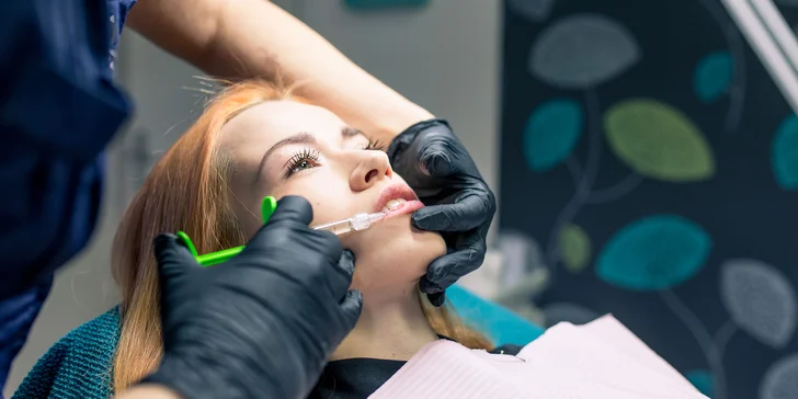 Vyplnenie vrások a pier kyselinou hyalurónovou alebo contouring tváre