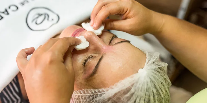 Chemický peeling alebo darčekový poukaz na kozmetické služby