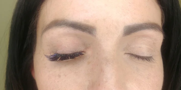 3D kašmírové či nano mihalnice alebo lifting & botox rias