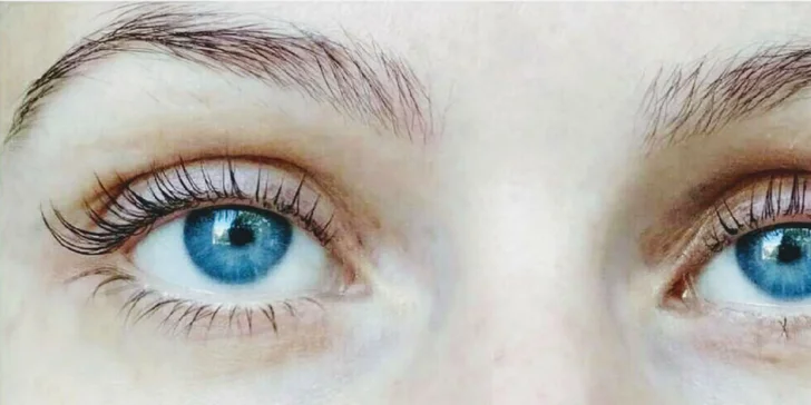 3D kašmírové či nano mihalnice alebo lifting & botox rias