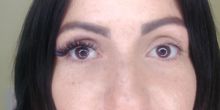 3D kašmírové či nano mihalnice alebo lifting & botox rias
