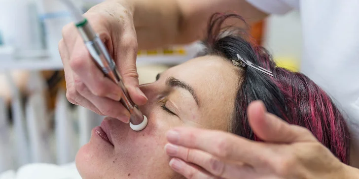 Mikrodermabrázia, manuálne čistenie, rádiofrekvencia alebo dermapen
