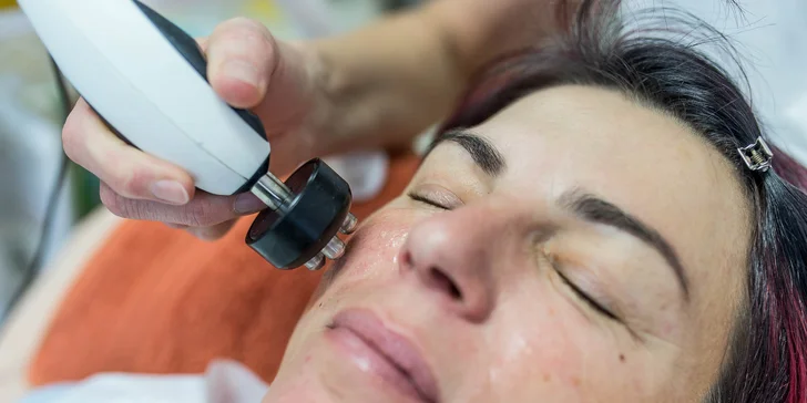 Mikrodermabrázia, manuálne čistenie, rádiofrekvencia alebo dermapen