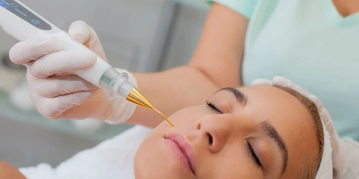 Plasma Lifting - novinka v boji proti starnutiu