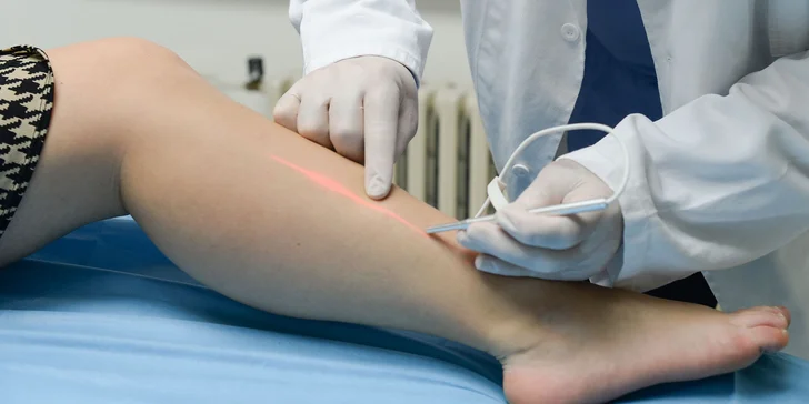 Vyšetrenie kŕčových žíl na klinike REVIVE