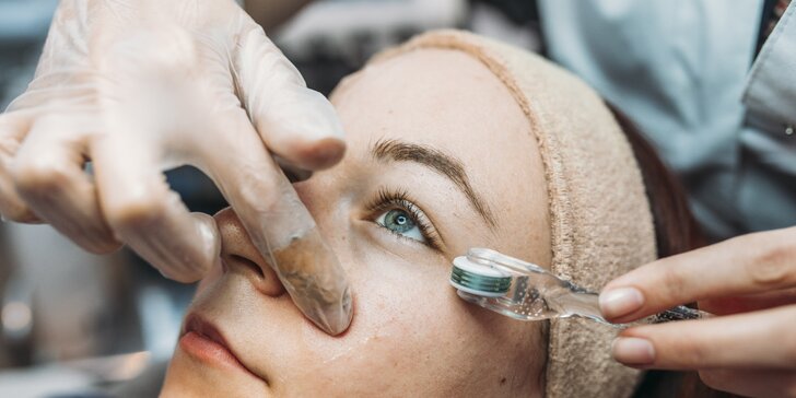 Omladzujúce ošetrenia očného okolia dermarollerom či galvánom