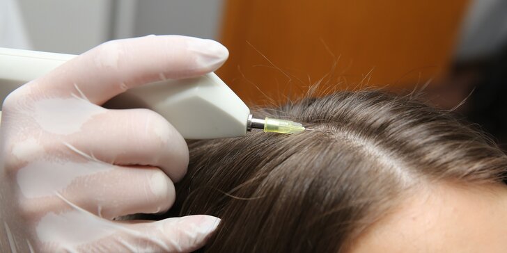 Podpora rastu vlasov či koniec vráskam, celulitíde a striám vďaka revolučnej karboxyterapii!