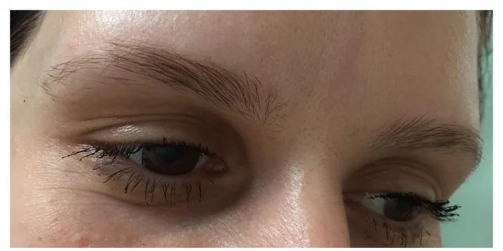 Vždy dokonale upravené obočie vďaka 3D microbladingu