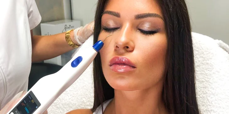 Blefaroplastika horných a dolných viečok pomocou prístroja Plaxpot