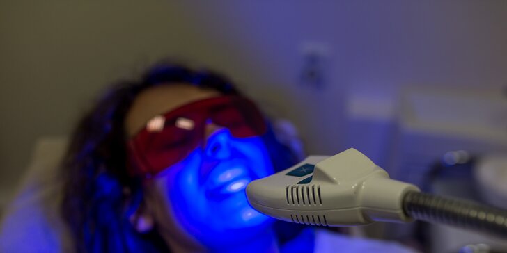 Žiarivo biely úsmev s laserovým bielením zubov bez peroxidu