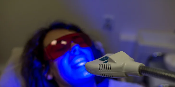 Žiarivo biely úsmev s laserovým bielením zubov bez peroxidu
